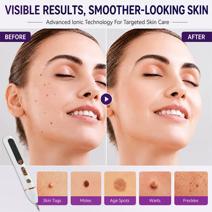 Precision Mole & Skin Tag Removal Pen